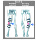 Bei X-oder O-Bein wird die Belastung auf die Gegenseite verlagert und sorgt somit für optimale Entlastung des Meniskus.